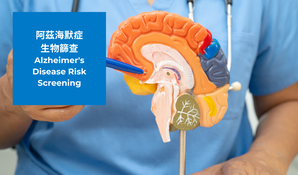 阿茲海默症生物篩查